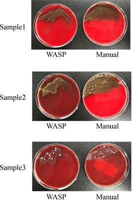 Copan Walk Away Specimen Processor (WASP) Automated System for Pathogen Detection in Female Reproductive Tract Specimens